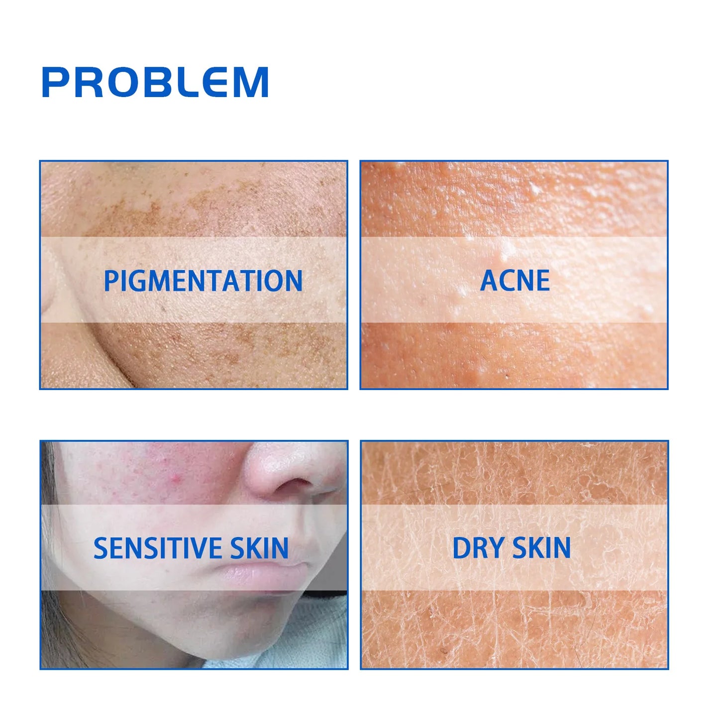 Hoygi Blueberry Face Cream Deep Hydration Smooths Fine Lines