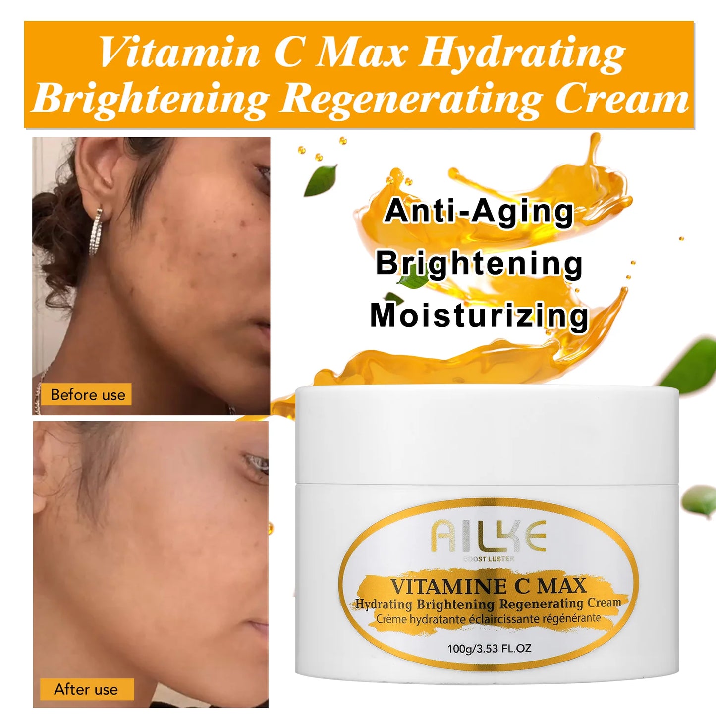 KYLIEFIT Vitamin C Whitening Serum For Dark Spot Brightening