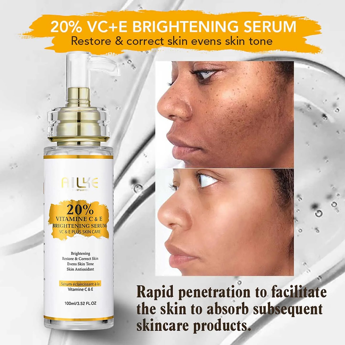 KYLIEFIT Vitamin C Whitening Serum For Dark Spot Brightening