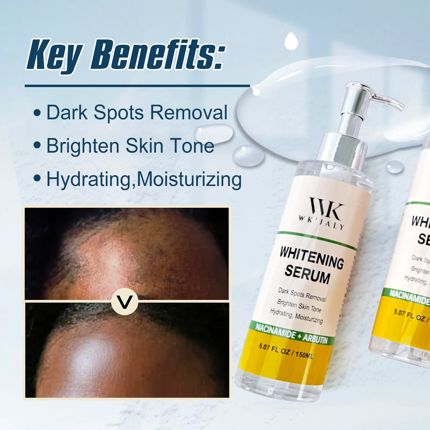 WK’JALY Whitening Serum For Dark Spots Niacinamide Arbutin Freckles
