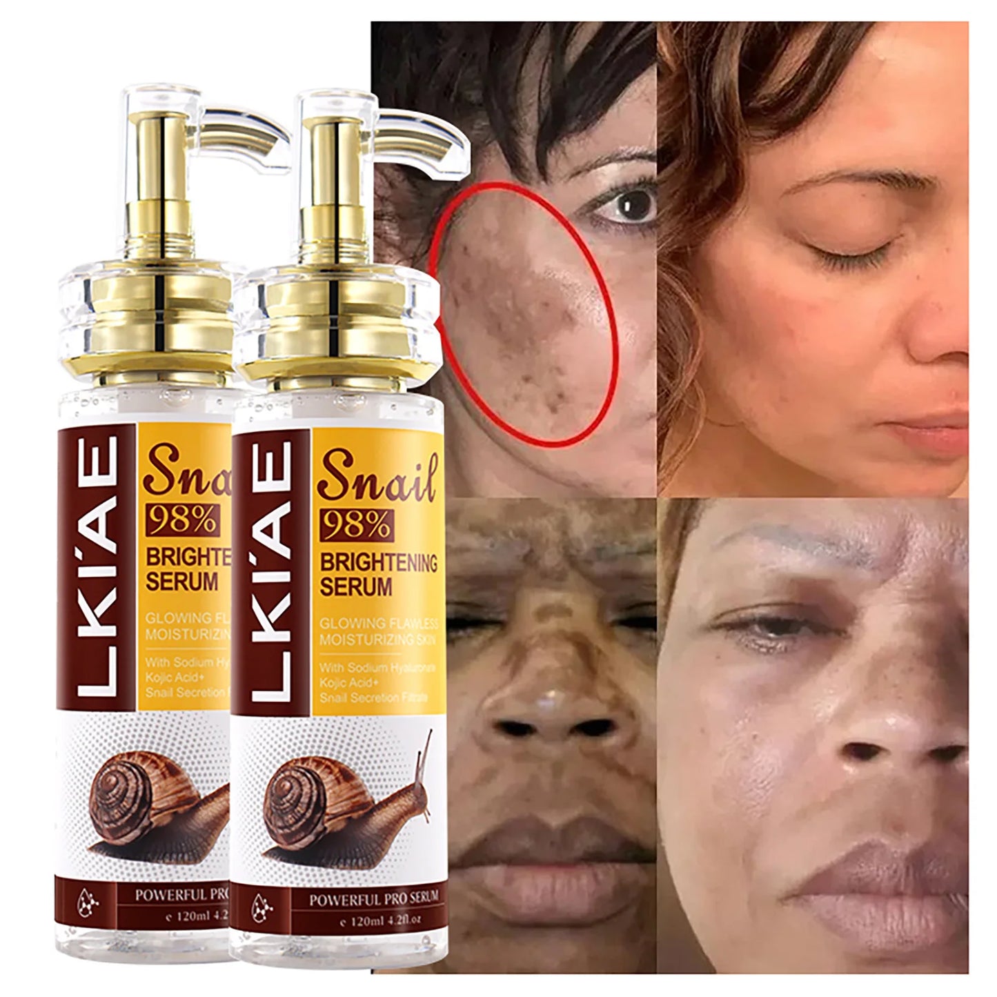 AILKE Natural Snail Brightening Serum For Face And Body