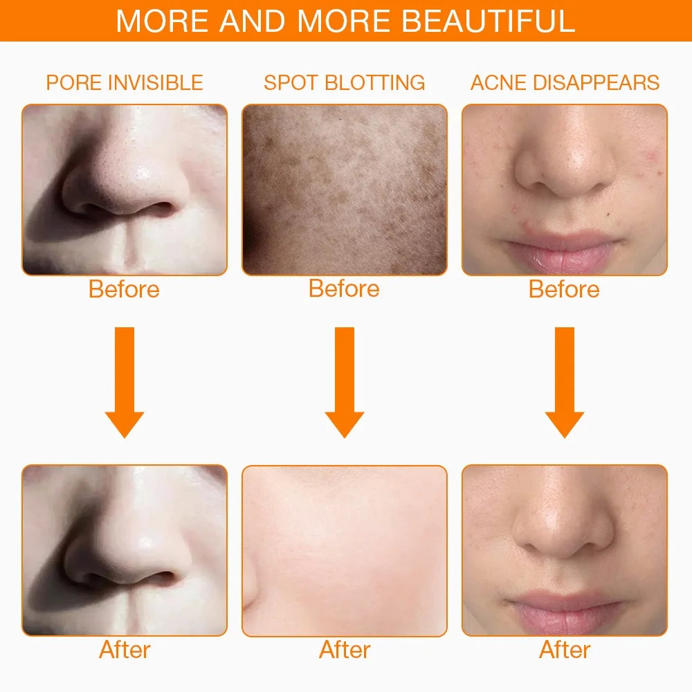 Iebilif LED Face Mask for Anti-Aging Skin Rejuvenation