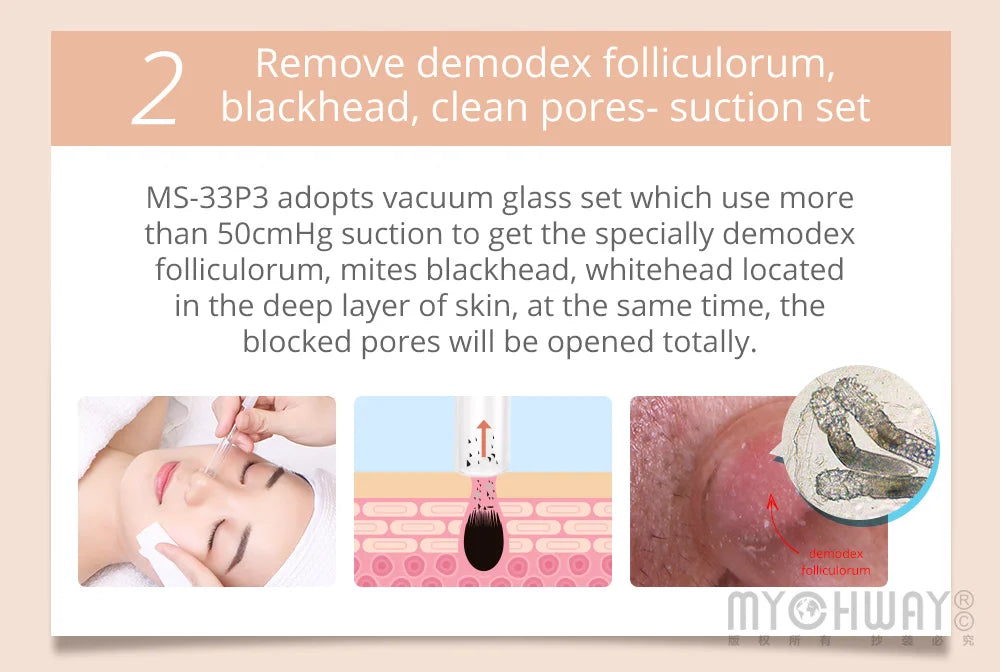 Mychway 3-in-1 Ultrasound Dermabrasion Facial Device